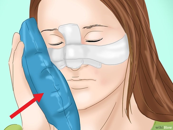 استفاده از کمپرس سرد در دوره نقاهت عمل بینی